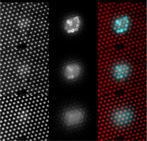 T cells (cyan) interacting with pillar arrays coated with OKT3 + CD28.6